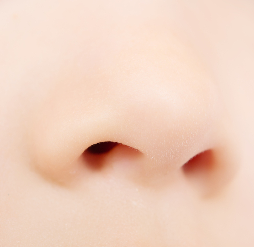 鼻孔縁形成の失敗は何が起こる？